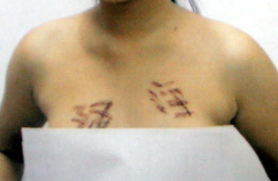 15岁女孩全身惨遭刻字续:疑犯交待犯罪事实