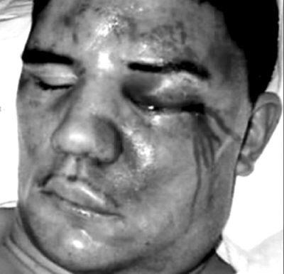 美国白人警官殴打非裔青年被判无罪(图)