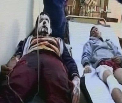 在提克里特警方招募站爆炸中受伤的年轻人,正在医院接受治疗。 在提克里特警方招募站爆炸中受伤的年轻人,正在医院接受治疗。