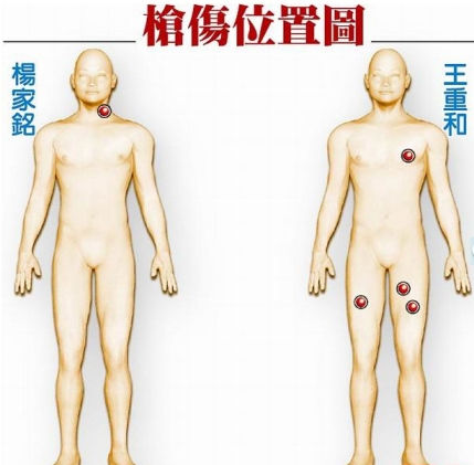 枪伤位置图警员王重和左胸中一枪、右大腿一枪、左大腿两枪,不治身亡,其友人杨家铭则因左颈中枪、子弹贯穿后脑,命在旦夕。台湾《苹果日报》图 枪伤位置图警员王重和左胸中一枪、右大腿一枪、左大腿两枪,不治身亡,其友人杨家铭则因左颈中枪、子弹贯穿后脑,命在旦夕。台湾《苹果日报》图