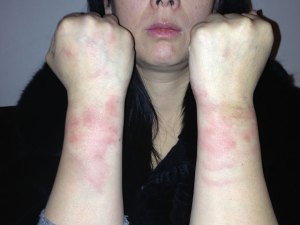 美华裔女购iPhone遭警电击警方执法合法性遭质疑